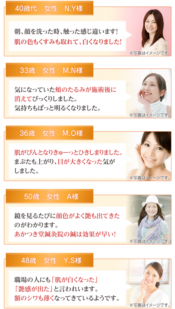 実際に美容鍼を受けた方の声